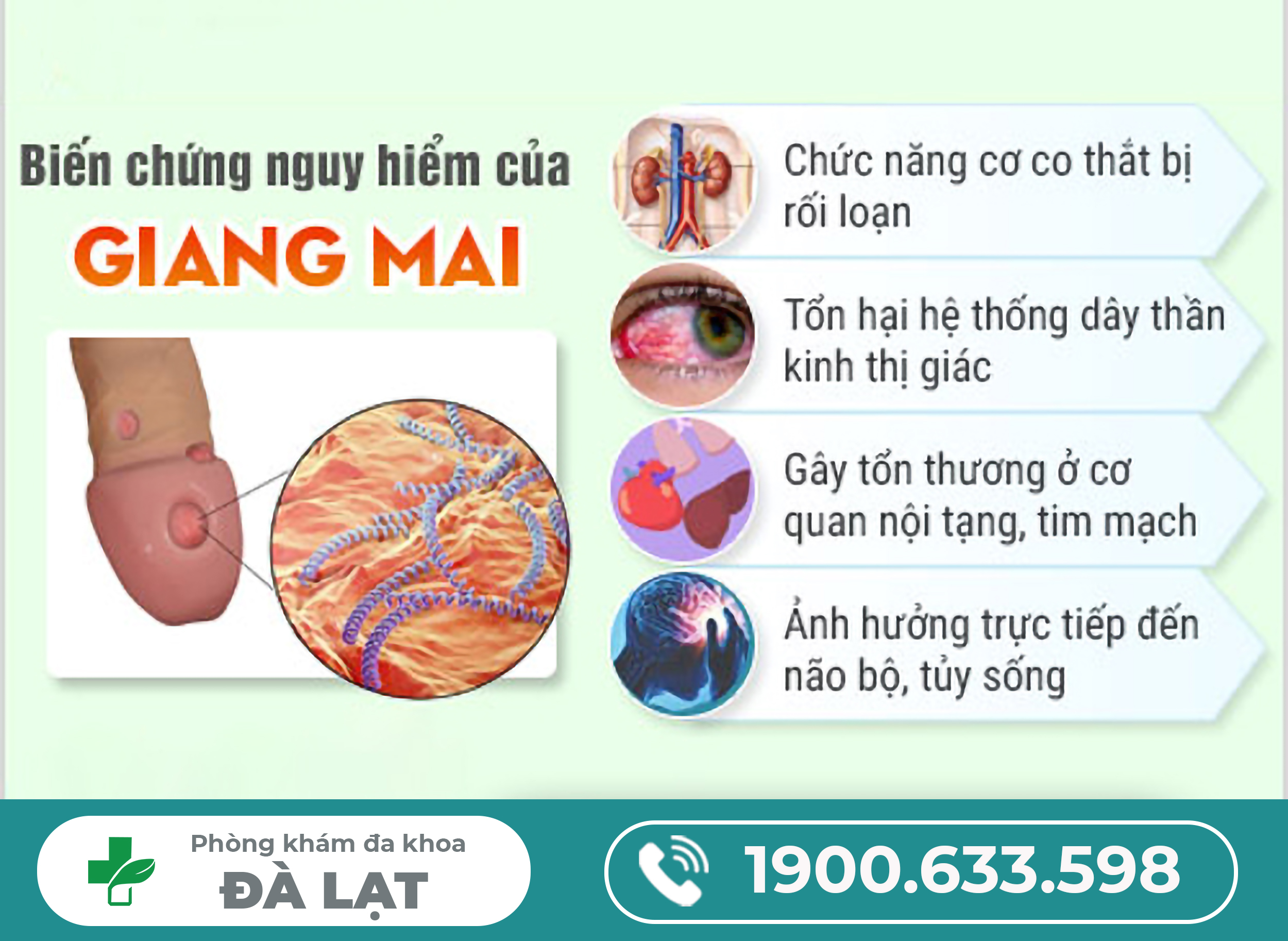 Hình ảnh minh họa